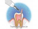 Planos odontológicos odontoserv
