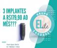 Implantes a R$179, 90