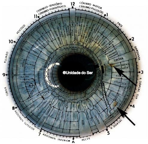 Curso de Iridologia Sistêmica Método Americano e OPI