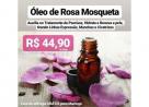 Óleo de Rosa Mosqueta Rejuvenescedor Psoríase Anti-rugas Anti-sinais Hidratante - Beleza e saúde