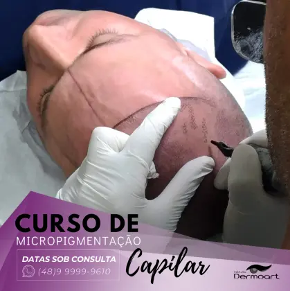 Micropigmentação Capilar