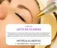Curso de Jato de Plasma