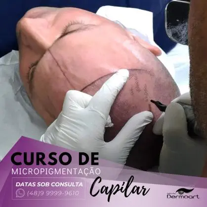 Curso de Micropigmentação Capilar