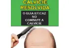 Calvície O Guia Definitivo contra Queda de Cabelo