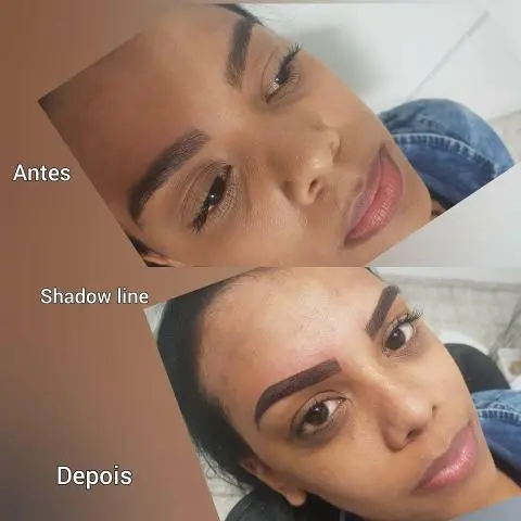 Micropigamentacao com anestesico