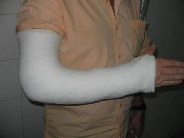 curso tecnico de gesso hospitalar