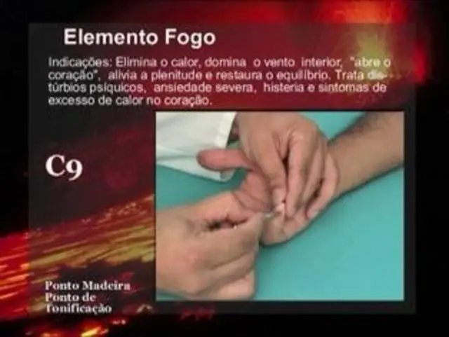 Cursos de acupuntura - cursos de formação profissional