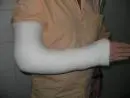 curso tecnico de gesso hospitalar